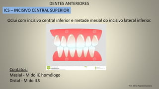 Prof. Sônia Popiolek Caetano
DENTES ANTERIORES
ICS – INCISIVO CENTRAL SUPERIOR
Oclui com incisivo central inferior e metade mesial do incisivo lateral inferior.
Contatos:
Mesial - M do IC homólogo
Distal - M do ILS
 