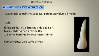 Prof. Sônia Popiolek Caetano
DENTES ANTERIORES
ILS – INCISIVO LATERAL SUPERIOR
Morfologia semelhante à do ICS, porém seu volume é menor.
Raiz
Única, cônica, mais larga na V do que na P.
Mais afilada do que a raiz do ICS.
1/3 apical bastante inclinado para a distal.
Comprimento: uma coroa e meia.
 