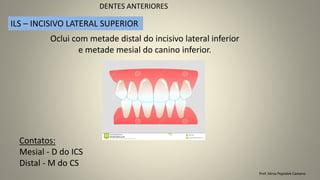 Prof. Sônia Popiolek Caetano
DENTES ANTERIORES
ILS – INCISIVO LATERAL SUPERIOR
Oclui com metade distal do incisivo lateral inferior
e metade mesial do canino inferior.
Contatos:
Mesial - D do ICS
Distal - M do CS
 