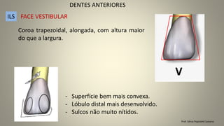 Prof. Sônia Popiolek Caetano
DENTES ANTERIORES
ILS
Coroa trapezoidal, alongada, com altura maior
do que a largura.
- Superfície bem mais convexa.
- Lóbulo distal mais desenvolvido.
- Sulcos não muito nítidos.
FACE VESTIBULAR
 