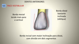 Borda incisal com maior inclinação para distal,
com divisão em dois segmentos
Borda distal
bastante
inclinada
(oblíqua)
Borda mesial
tende mais para
a vertical
DENTES ANTERIORES
ILS FACE VESTIBULAR
 