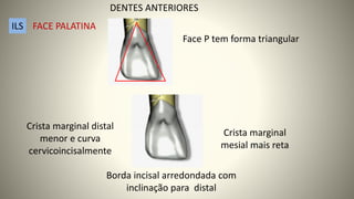 Face P tem forma triangular
Crista marginal
mesial mais reta
Crista marginal distal
menor e curva
cervicoincisalmente
Borda incisal arredondada com
inclinação para distal
FACE PALATINA
ILS
DENTES ANTERIORES
 