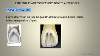 ESTRUTURAS ANATÔMICAS DOS DENTES ANTERIORES
Prof. Sônia Popiolek Caetano
É uma depressão da face Lingual (P) delimitada pela borda incisal,
cristas marginais e cíngulo
FOSSA LINGUAL (P)
 