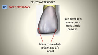 Maior convexidade
próxima ao 1/3
incisal
Face distal bem
menor que a
mesial, mais
convexa.
ILS FACES PROXIMAIS
DENTES ANTERIORES
 