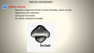 Quando o segmento distal é muito inclinado, notam-se dois
segmentos bem distintos:
Um quase horizontal
Um distal, bastante inclinado
ILS BORDA INCISAL
DENTES ANTERIORES
 