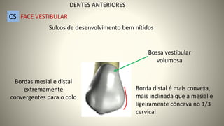 Sulcos de desenvolvimento bem nítidos
Bossa vestibular
volumosa
Bordas mesial e distal
extremamente
convergentes para o colo
Borda distal é mais convexa,
mais inclinada que a mesial e
ligeiramente côncava no 1/3
cervical
DENTES ANTERIORES
CS FACE VESTIBULAR
 