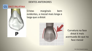 Cristas marginais bem
evidentes, a mesial mais longa e
larga que a distal.
Curvatura na face
distal é mais
acentuada do que na
face mesial
DENTES ANTERIORES
CS FACE PALATINA
Prof. Sônia Popiolek Caetano
 