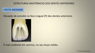 ESTRUTURAS ANATÔMICAS DOS DENTES ANTERIORES
Prof. Sônia Popiolek Caetano
Elevação de esmalte na face Lingual (P) dos dentes anteriores
CRISTA MEDIANA
É mais evidente em caninos, no seu terço médio.
 