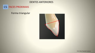 Forma triangular
DENTES ANTERIORES
CS FACES PROXIMAIS
Prof. Sônia Popiolek Caetano
 