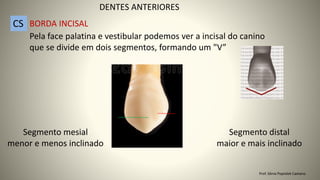 DENTES ANTERIORES
CS BORDA INCISAL
Pela face palatina e vestibular podemos ver a incisal do canino
que se divide em dois segmentos, formando um "V”
Segmento mesial
menor e menos inclinado
Segmento distal
maior e mais inclinado
Prof. Sônia Popiolek Caetano
 