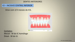 Prof. Sônia Popiolek Caetano
DENTES ANTERIORES
ICI – INCISIVO CENTRAL INFERIOR
Oclui com 2/3 mesiais do ICS.
Contatos:
Mesial - M do IC homólogo
Distal - M do ILI
 