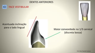 Maior convexidade no 1/3 cervical
(discreta bossa)
Acentuada inclinação
para o lado lingual
DENTES ANTERIORES
ICI FACE VESTIBULAR
Prof. Sônia Popiolek Caetano
 