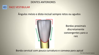 Bordas proximais
discretamente
convergentes para a
raiz
Ângulos mésio e disto-incisal sempre retos ou agudos
Borda cervical com pouca curvatura e convexa para apical
DENTES ANTERIORES
ICI FACE VESTIBULAR
Prof. Sônia Popiolek Caetano
 