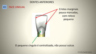O pequeno cíngulo é centralizado, não possui sulcos
Cristas marginais
pouco marcadas,
com relevo
pequeno
DENTES ANTERIORES
ICI FACE LINGUAL
Prof. Sônia Popiolek Caetano
 