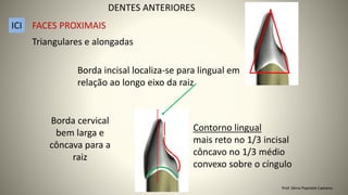 Triangulares e alongadas
Borda incisal localiza-se para lingual em
relação ao longo eixo da raiz
Borda cervical
bem larga e
côncava para a
raiz
Contorno lingual
mais reto no 1/3 incisal
côncavo no 1/3 médio
convexo sobre o cíngulo
DENTES ANTERIORES
ICI FACES PROXIMAIS
Prof. Sônia Popiolek Caetano
 