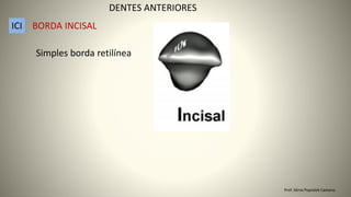 Simples borda retilínea
DENTES ANTERIORES
ICI BORDA INCISAL
Prof. Sônia Popiolek Caetano
 