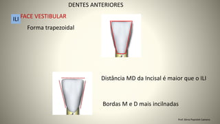 Forma trapezoidal
DENTES ANTERIORES
ILI FACE VESTIBULAR
Distância MD da Incisal é maior que o ILI
Bordas M e D mais incilnadas
Prof. Sônia Popiolek Caetano
 