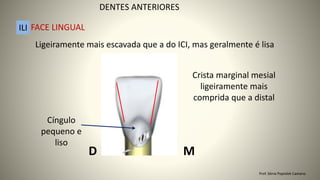 Ligeiramente mais escavada que a do ICI, mas geralmente é lisa
Crista marginal mesial
ligeiramente mais
comprida que a distal
Cíngulo
pequeno e
liso
M
D
DENTES ANTERIORES
ILI FACE LINGUAL
Prof. Sônia Popiolek Caetano
 