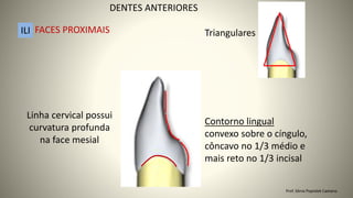 Contorno lingual
convexo sobre o cíngulo,
côncavo no 1/3 médio e
mais reto no 1/3 incisal
Linha cervical possui
curvatura profunda
na face mesial
Triangulares
DENTES ANTERIORES
ILI FACES PROXIMAIS
Prof. Sônia Popiolek Caetano
 