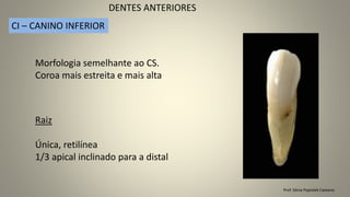 Prof. Sônia Popiolek Caetano
DENTES ANTERIORES
CI – CANINO INFERIOR
Morfologia semelhante ao CS.
Coroa mais estreita e mais alta
Raiz
Única, retilínea
1/3 apical inclinado para a distal
 