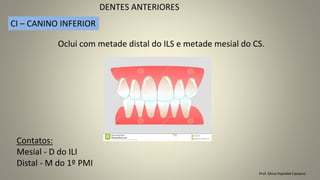 Prof. Sônia Popiolek Caetano
DENTES ANTERIORES
CI – CANINO INFERIOR
Contatos:
Mesial - D do ILI
Distal - M do 1º PMI
Oclui com metade distal do ILS e metade mesial do CS.
 