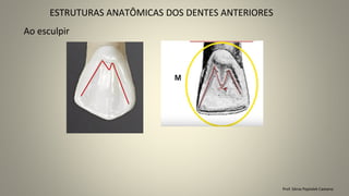 Prof. Sônia Popiolek Caetano
Ao esculpir
ESTRUTURAS ANATÔMICAS DOS DENTES ANTERIORES
 