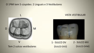 VISTA VESTIBULAR
2 - SULCO MV
1 - SULCO DV
1 1
2
2
O 1ºMI tem 5 cúspides: 2 Linguais e 3 Vestibulares
Tem 2 sulcos vestibulares
L
D
V
M
(SULCO OVD) (SULCO OVM)
 