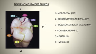 1- MESIODISTAL (MD)
2- OCLUSOVESTIBULAR DISTAL (DV)
3 - OCLUSOVESTIBULAR MESIAL (MV)
4 – OCLUSOLINGUAL (L)
5 – DISTAL (D)
6 – MESIAL (L)
NOMENCLATURA DOS SULCOS
M
V
L
D
31
 