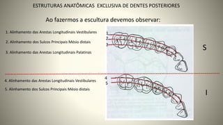 Ao fazermos a escultura devemos observar:
37
ESTRUTURAS ANATÔMICAS EXCLUSIVA DE DENTES POSTERIORES
1. Alinhamento das Arestas Longitudinais Vestibulares
2. Alinhamento dos Sulcos Principais Mésio distais
3. Alinhamento das Arestas Longitudinais Palatinas
4. Alinhamento das Arestas Longitudinais Vestibulares
5. Alinhamento dos Sulcos Principais Mésio distais
S
I
1
2
3
4
5
 