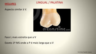MOLARES LINGUAL / PALATINA
Aspecto similar à V.
Prof. Sônia Popiolek Caetano
Exceto 1º MS onde a P é mais larga que a V
Face L mais estreita que a V
 