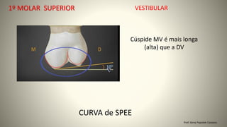 1º MOLAR SUPERIOR
Prof. Sônia Popiolek Caetano
VESTIBULAR
CURVA de SPEE
Cúspide MV é mais longa
(alta) que a DV
 