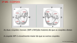 1º MS - CÚSPIDES
Prof. Sônia Popiolek Caetano
As duas cúspides mesiais (MP e MV)são maiores do que as cúspides distais
A cúspide MP é visivelmente maior do que as outras cúspides
 