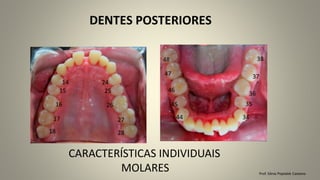 Prof. Sônia Popiolek Caetano
DENTES POSTERIORES
CARACTERÍSTICAS INDIVIDUAIS
MOLARES
18
17
16
15
14
28
27
26
25
24
35
38
37
36
48
47
46
45
44 34
 