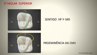1º MOLAR SUPERIOR
Prof. Sônia Popiolek Caetano
SENTIDO VP > MD
PROEMINÊNCIA DA CMV
 