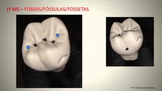 Prof. Sônia Popiolek Caetano
1º MS – FOSSAS/FÓSSULAS/FOSSETAS
 