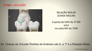 Prof. Sônia Popiolek Caetano
1º MS – OCLUSÃO
1º MI 2º MI
1º MS RELAÇÃO MOLAR
(CHAVE MOLAR)
A ponta da CMV do 1º MS
oclui
no sulco MV do 1ºMI
As Chaves da Oclusão Perfeita de Andrews são 6, a 1ª é a Relação Molar.
 