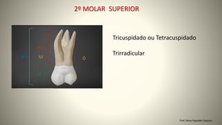 Prof. Sônia Popiolek Caetano
2º MOLAR SUPERIOR
Tricuspidado ou Tetracuspidado
Trirradicular
 