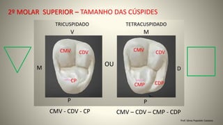 Prof. Sônia Popiolek Caetano
2º MOLAR SUPERIOR – TAMANHO DAS CÚSPIDES
CMV - CDV - CP CMV – CDV – CMP - CDP
 