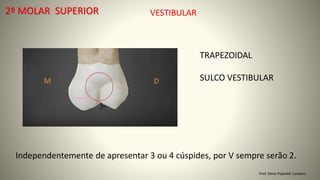Prof. Sônia Popiolek Caetano
2º MOLAR SUPERIOR
TRAPEZOIDAL
SULCO VESTIBULAR
VESTIBULAR
Independentemente de apresentar 3 ou 4 cúspides, por V sempre serão 2.
 