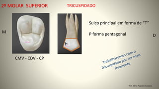 Prof. Sônia Popiolek Caetano
2º MOLAR SUPERIOR
CMV - CDV - CP
D
M
Sulco principal em forma de “T”
P forma pentagonal
TRICUSPIDADO
 