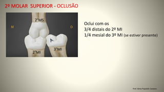 Prof. Sônia Popiolek Caetano
2º MOLAR SUPERIOR - OCLUSÃO
Oclui com os
3/4 distais do 2º MI
1/4 mesial do 3º MI (se estiver presente)
2°MS
2°MI
3°MI
 