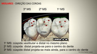 MOLARES - DIREÇÃO DAS COROAS
Prof. Sônia Popiolek Caetano
1o MS: cúspide vestibular e distal no mesmo plano
2o MS: cúspide distal projeta-se para o centro do dente
3o MS: cúspide distal projeta-se mais ainda, para o centro do dente
1o MS
3º MS 2º MS
 
