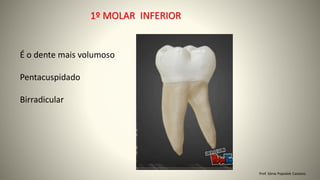 Prof. Sônia Popiolek Caetano
1º MOLAR INFERIOR
É o dente mais volumoso
Pentacuspidado
Birradicular
 