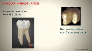 Prof. Sônia Popiolek Caetano
1º MOLAR INFERIOR - RAÍZES
Apresenta duas raízes:
MESIAL e DISTAL
Raiz mesial e distal
com 2 condutos cada
 