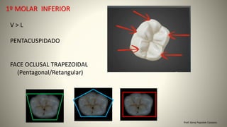 Prof. Sônia Popiolek Caetano
1º MOLAR INFERIOR
V > L
PENTACUSPIDADO
FACE OCLUSAL TRAPEZOIDAL
(Pentagonal/Retangular)
 