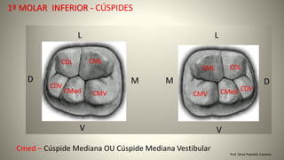 Prof. Sônia Popiolek Caetano
1º MOLAR INFERIOR - CÚSPIDES
Cmed – Cúspide Mediana OU Cúspide Mediana Vestibular
 