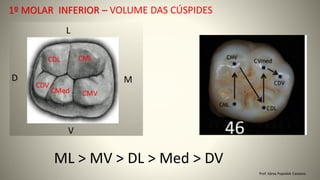 Prof. Sônia Popiolek Caetano
1º MOLAR INFERIOR – VOLUME DAS CÚSPIDES
ML > MV > DL > Med > DV
 
