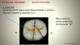 SULCOS PRINCIPAIS
1. Sulco MD
Sai da fóssula M, passa pelas fossas centrais e vai até a
fóssula D. Separa as cúspides V e L
Prof. Sônia Popiolek Caetano
1º MOLAR INFERIOR
D
M
Não é retilíneo
Linhas quebradas
Em forma de “W”
 