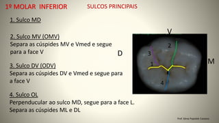 SULCOS PRINCIPAIS
1. Sulco MD
2. Sulco MV (OMV)
Separa as cúspides MV e Vmed e segue
para a face V
3. Sulco DV (ODV)
Separa as cúspides DV e Vmed e segue para
a face V
4. Sulco OL
Perpenducular ao sulco MD, segue para a face L.
Separa as cúspides ML e DL
1
2
4
D
M
V
Prof. Sônia Popiolek Caetano
1º MOLAR INFERIOR
3
1
 