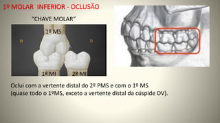 1º MOLAR INFERIOR - OCLUSÃO
“CHAVE MOLAR”
Oclui com a vertente distal do 2º PMS e com o 1º MS
(quase todo o 1ºMS, exceto a vertente distal da cúspide DV).
1º MS
2º MI
1º MI
 